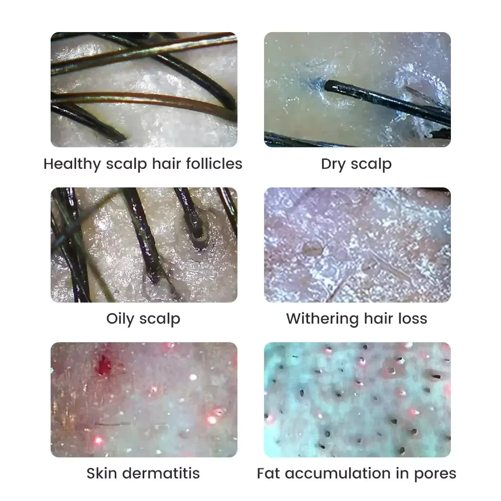 Wireless 1000X Digital Dermatoscope & Scalp Skin Analyzer Microscope